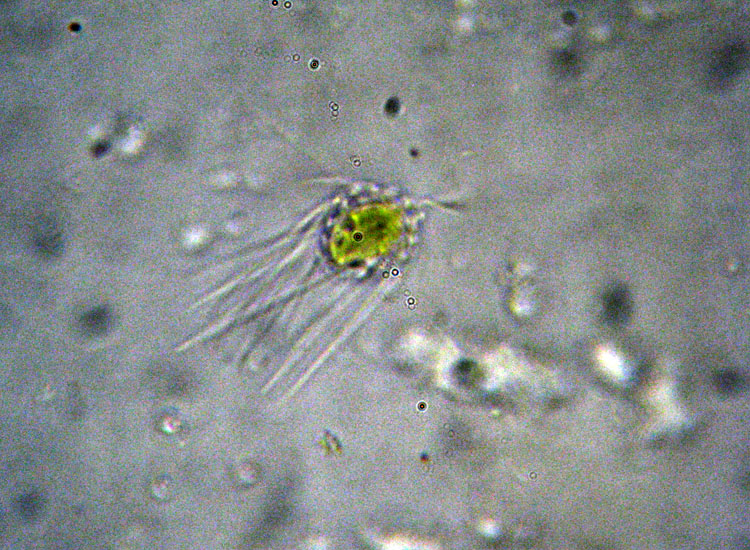 Probabile Mallomonas acaroides